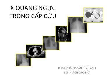 Bài giảng X quang ngực trong cấp cứu