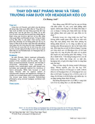 Thay đổi mặt phẳng nhai và tăng trưởng hàm dưới với Headgear kéo cổ