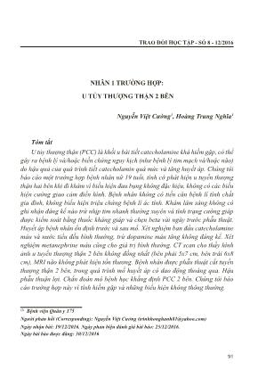 Nhân 1 trường hợp: u tủy thượng thận 2 bên