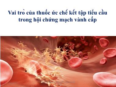 Bài giảng Vai trò của thuốc ức chế kết tập tiểu cầu trong hội chứng mạch vành cấp