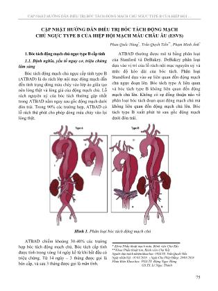 Cập nhật hướng dẫn điều trị bóc tách động mạch chủ ngực type b của hiệp hội mạch máu châu Âu (ESVS)