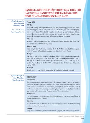 Đánh giá kết quả phẫu thuật gãy trên lồi cầu xương cánh tay ở trẻ em bằng ghim đinh qua da dưới màn tăng sáng