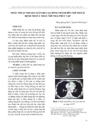Phẫu thuật nội soi toàn bộ tạo hình thành bên nhĩ trái ở bệnh nhân u nhầy nhĩ trái phức tạp