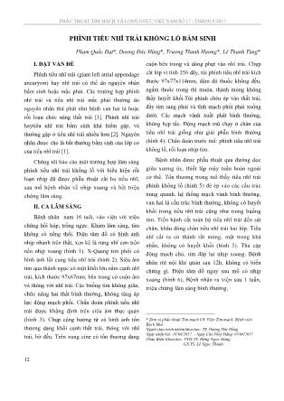 Phình tiểu nhĩ trái khổng lồ bẩm sinh